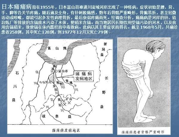 妇中町熊野地区的奇病——痛痛病