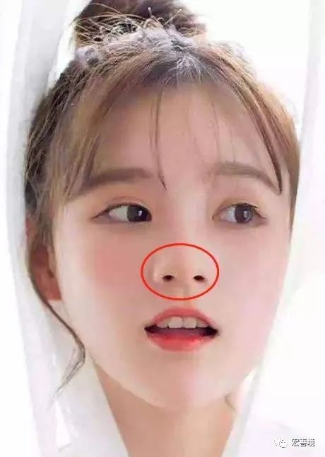 鼻相总论
