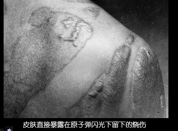 广岛原子弹爆炸